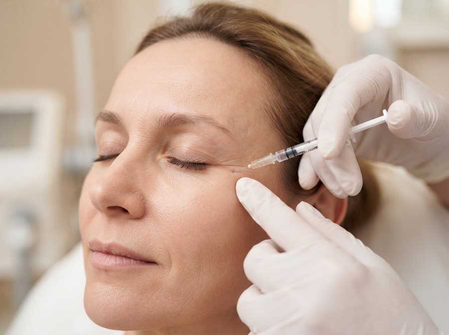 Aplicación precisa de botox junto al contorno de ojos